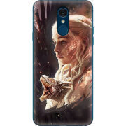 Чехол Uprint LG Q7 / Q7 Plus  
