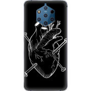 Чехол Uprint Nokia 9 