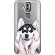 Прозрачный чехол Uprint Nokia 8.1 Husky