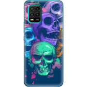 Чехол BoxFace Xiaomi Mi 10 Lite 