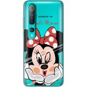 Прозрачный чехол BoxFace Xiaomi Mi 10 Lady M