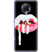 Чехол BoxFace Poco F2 Pro 