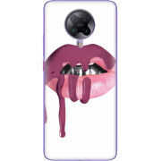 Чехол BoxFace Poco F2 Pro 