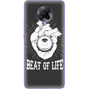 Чехол BoxFace Poco F2 Pro 