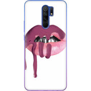Чехол BoxFace Xiaomi Redmi 9 