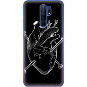 Чехол BoxFace Xiaomi Redmi 9 