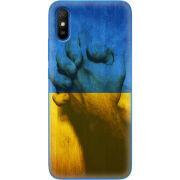 Чехол BoxFace Xiaomi Redmi 9A Handshake