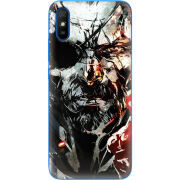 Чехол BoxFace Xiaomi Redmi 9A 