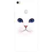 Чехол Uprint Xiaomi Mi Max 