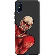 Черный чехол BoxFace Xiaomi Redmi 9A Титан