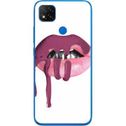 Чехол Uprint Xiaomi Redmi 9C 