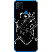 Чехол Uprint Xiaomi Redmi 9C 