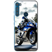 Чехол BoxFace Motorola One Fusion Plus 