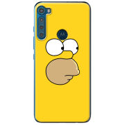 Чехол BoxFace Motorola One Fusion Plus 