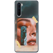 Чехол BoxFace OnePlus Nord 