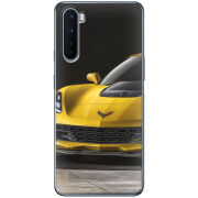 Чехол BoxFace OnePlus Nord Corvette Z06