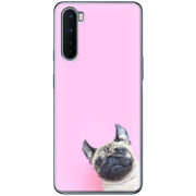 Чехол BoxFace OnePlus Nord 