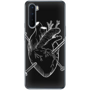 Чехол BoxFace OnePlus Nord 