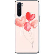 Чехол BoxFace OnePlus Nord 