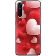 Чехол BoxFace OnePlus Nord 