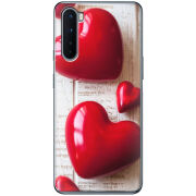 Чехол BoxFace OnePlus Nord 