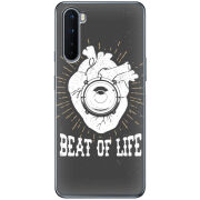 Чехол BoxFace OnePlus Nord 