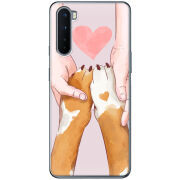 Чехол BoxFace OnePlus Nord 