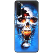 Чехол BoxFace OnePlus Nord 