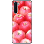 Чехол BoxFace OnePlus Nord 