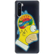 Чехол BoxFace OnePlus Nord 