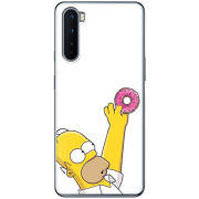 Чехол BoxFace OnePlus Nord 