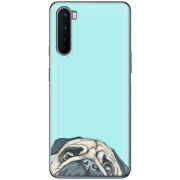 Чехол BoxFace OnePlus Nord 