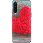 Чехол BoxFace OnePlus Nord 