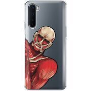 Прозрачный чехол BoxFace OnePlus Nord Титан