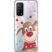 Прозрачный чехол BoxFace Xiaomi Mi 10T/ Mi 10T Pro Winter Deer