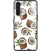 Защитный чехол BoxFace Glossy Panel OnePlus Nord 