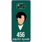 Чехол BoxFace Poco X3 siquid game 456