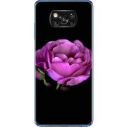 Чехол BoxFace Poco X3 