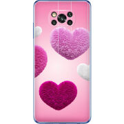 Чехол BoxFace Poco X3 