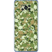 Чехол BoxFace Poco X3 