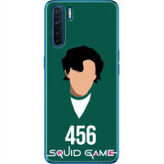 Чехол BoxFace OPPO A91 siquid game 456