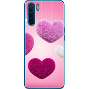 Чехол BoxFace OPPO A91 