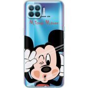 Прозрачный чехол BoxFace OPPO A93/ Reno4 Lite Mister M