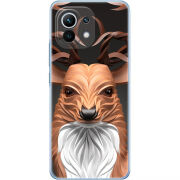 Чехол BoxFace Xiaomi Mi 11 