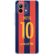 Чехол BoxFace Xiaomi Mi 11 Messi 10
