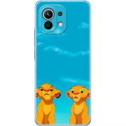 Чехол BoxFace Xiaomi Mi 11 