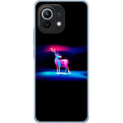 Чехол BoxFace Xiaomi Mi 11 