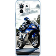 Чехол BoxFace Xiaomi Mi 11 