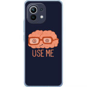 Чехол BoxFace Xiaomi Mi 11 
