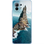 Чехол BoxFace Xiaomi Mi 11 